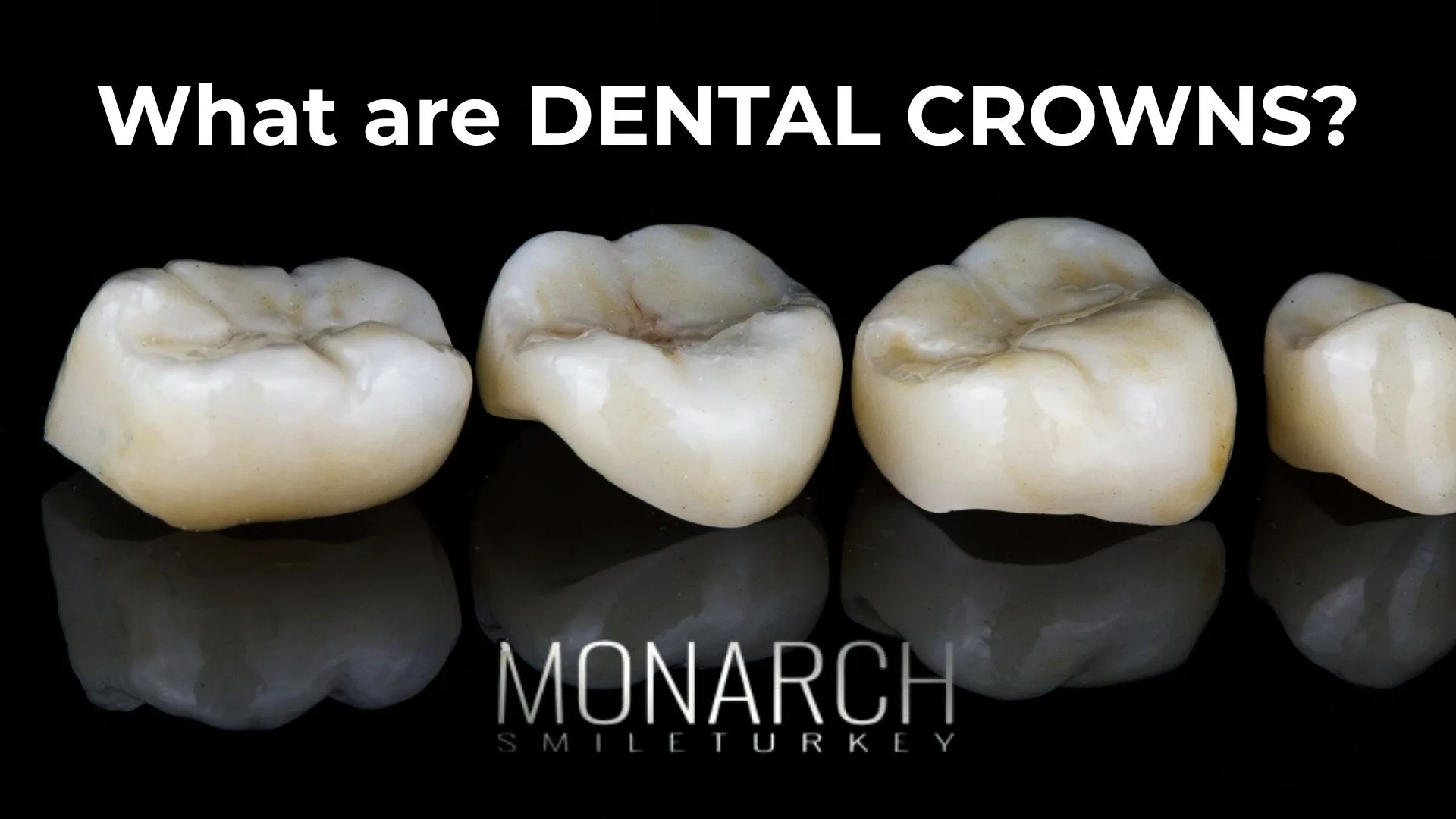 what-are-crowns-for-teeth?