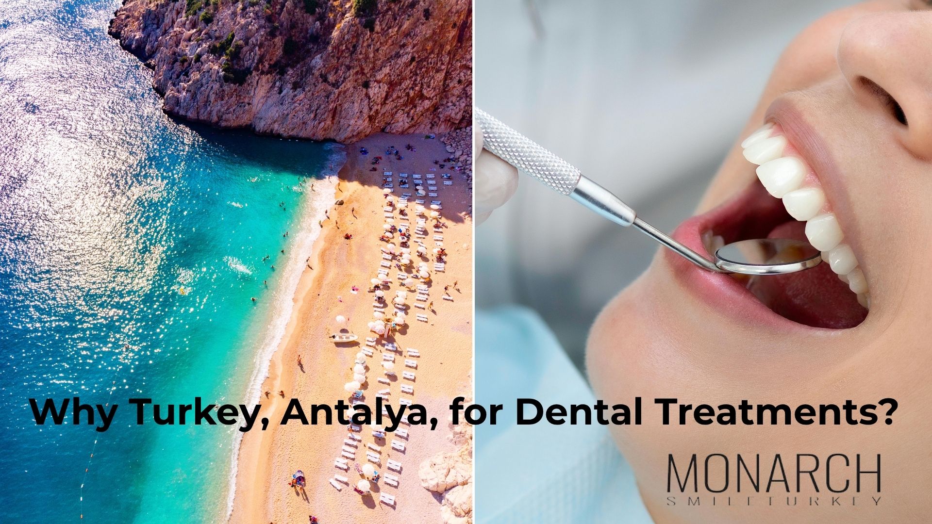 Why Choose Turkey, Antalya, for Dental Treatments?