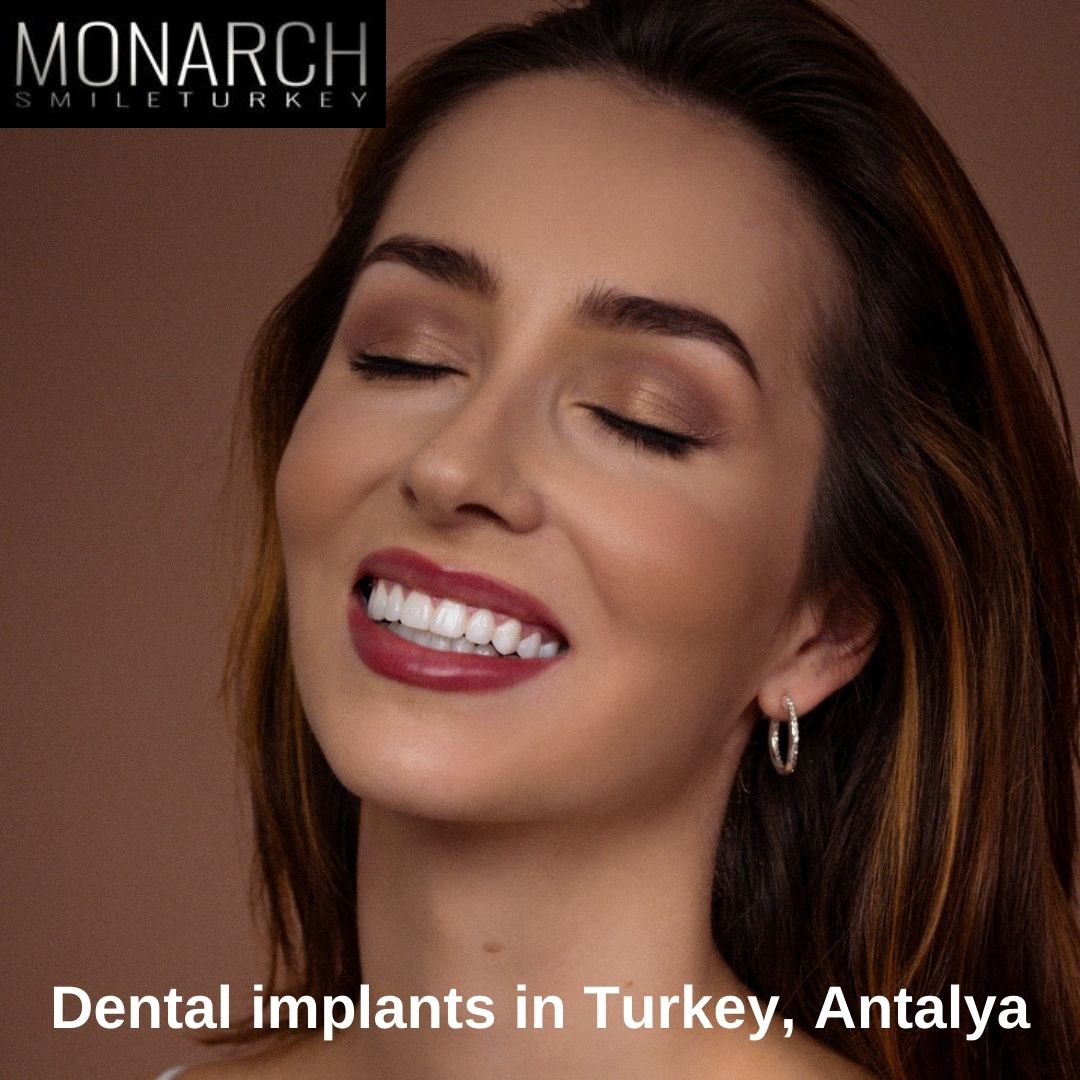 why-should-you-choose-turkey-antalya-for-implants