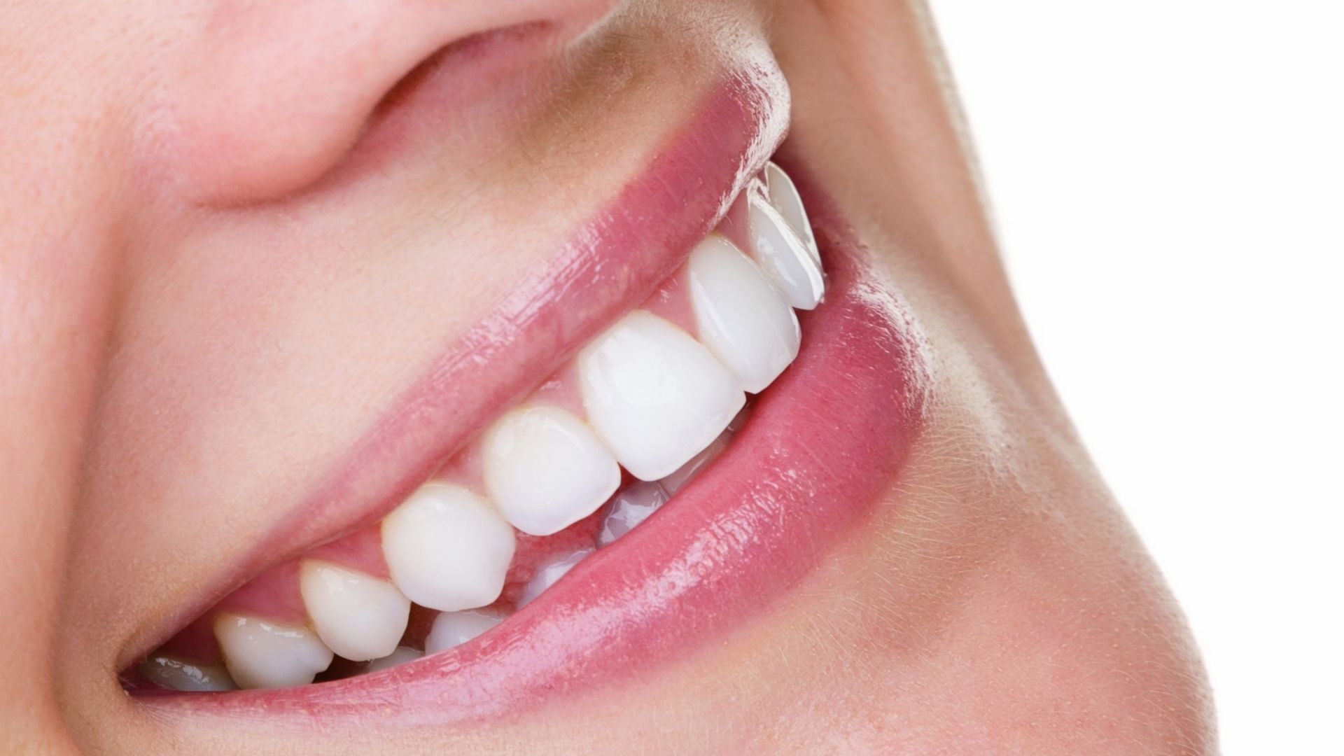 In-office teeth whitening