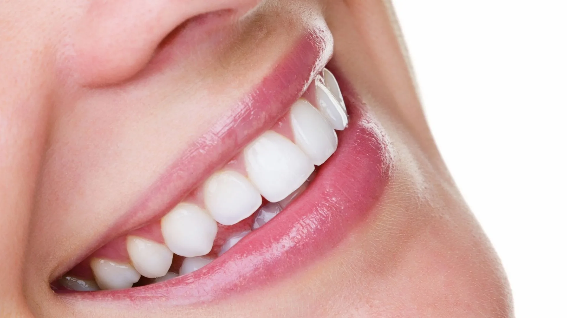 In-office teeth whitening In-office teeth whitening